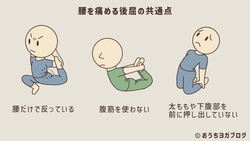 後屈で腰を痛める原因を表したイラスト入り図解（後屈で腰だけが反っている様子、腹筋を使わず反っている様子、太ももや下腹部を押し出せていない様子を解説している）